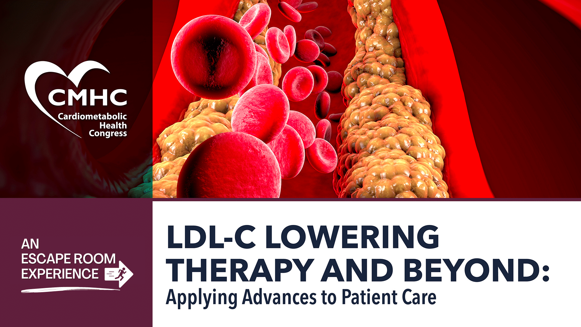 LDL-Lowering Therapy and Beyond