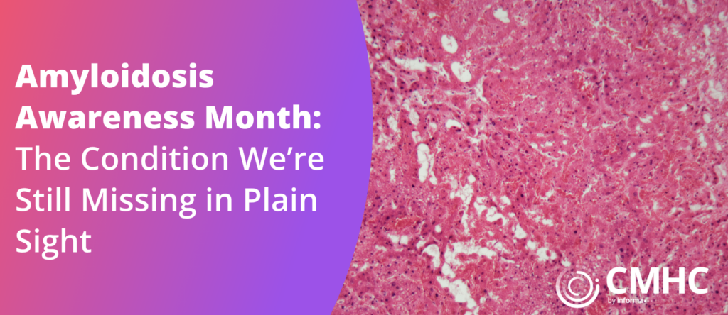 Amyloidosis